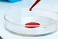 Anaemia Profile