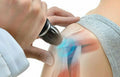 Magnetic Shockwave Therapy